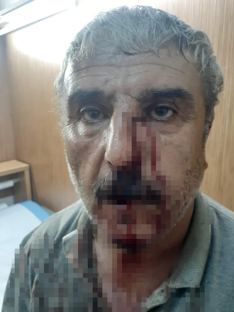 Acıpayam’da Aile Hekimi ile Emekli Öğretmen Arasında Mesai Tartışması Kavgaya Dönüştü